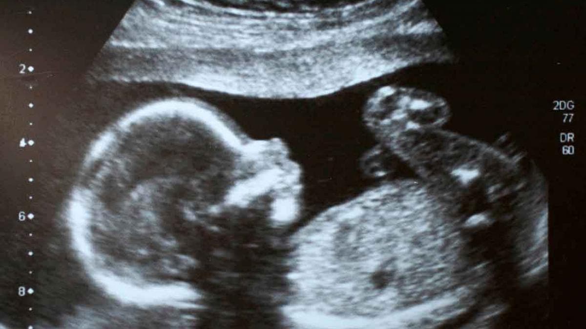 Pro-life Bill in Utah Passes