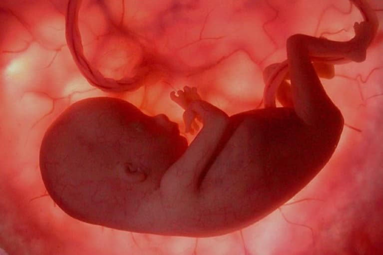 The Fall of Roe: A Moment of Celebration and a Call to Action for Latter-day Saints